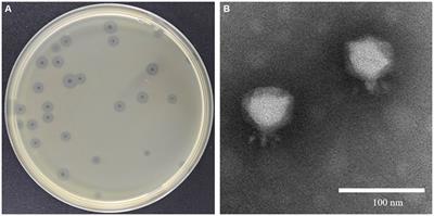 Engineered endolysin of Klebsiella pneumoniae phage is a potent and broad-spectrum bactericidal agent against “ESKAPEE” pathogens